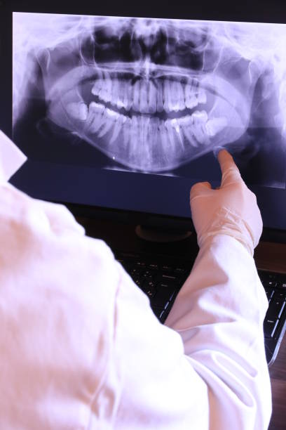 Best Dental Abscess Treatment in Gold Canyon, AZ